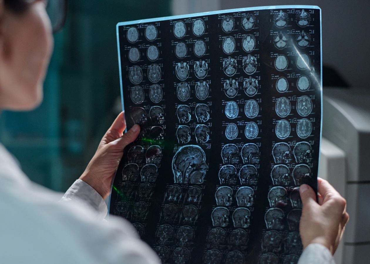 Demystifying dementia - WHYY