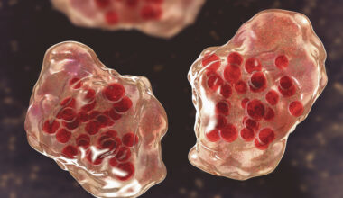 Officials warn of potential measles exposure at a central Pennsylvania Kohl’s