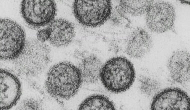 Local health experts share Pennsylvania's response to hantavirus