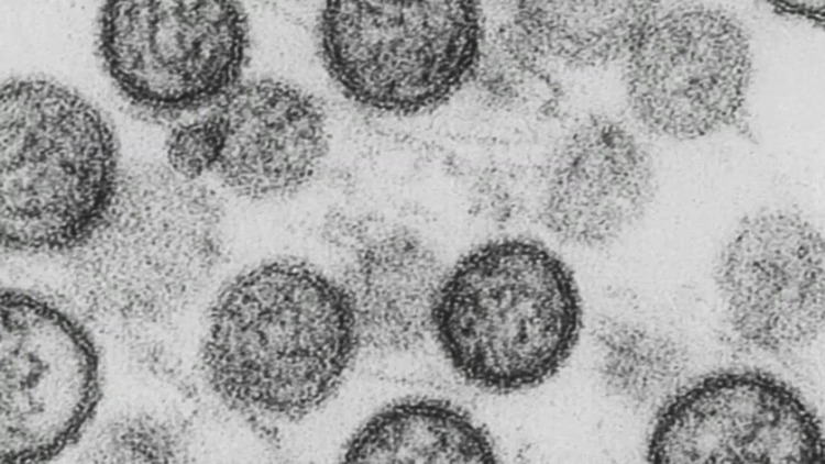 Local health experts share Pennsylvania's response to hantavirus