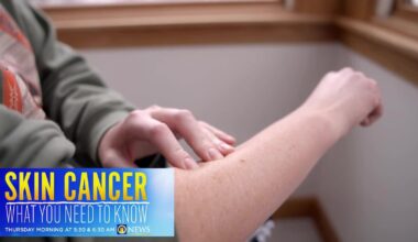New technology being used in Pittsburgh to help doctors spot skin cancer