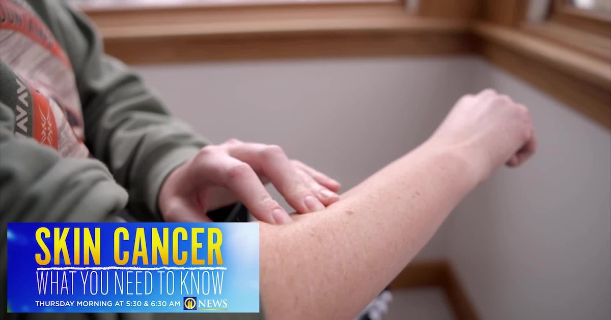 New technology being used in Pittsburgh to help doctors spot skin cancer