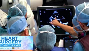 New procedure to fix common heart issue being performed in Pittsburgh – WPXI