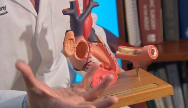 New procedure to fix common heart issue being performed in Pittsburgh – WPXI