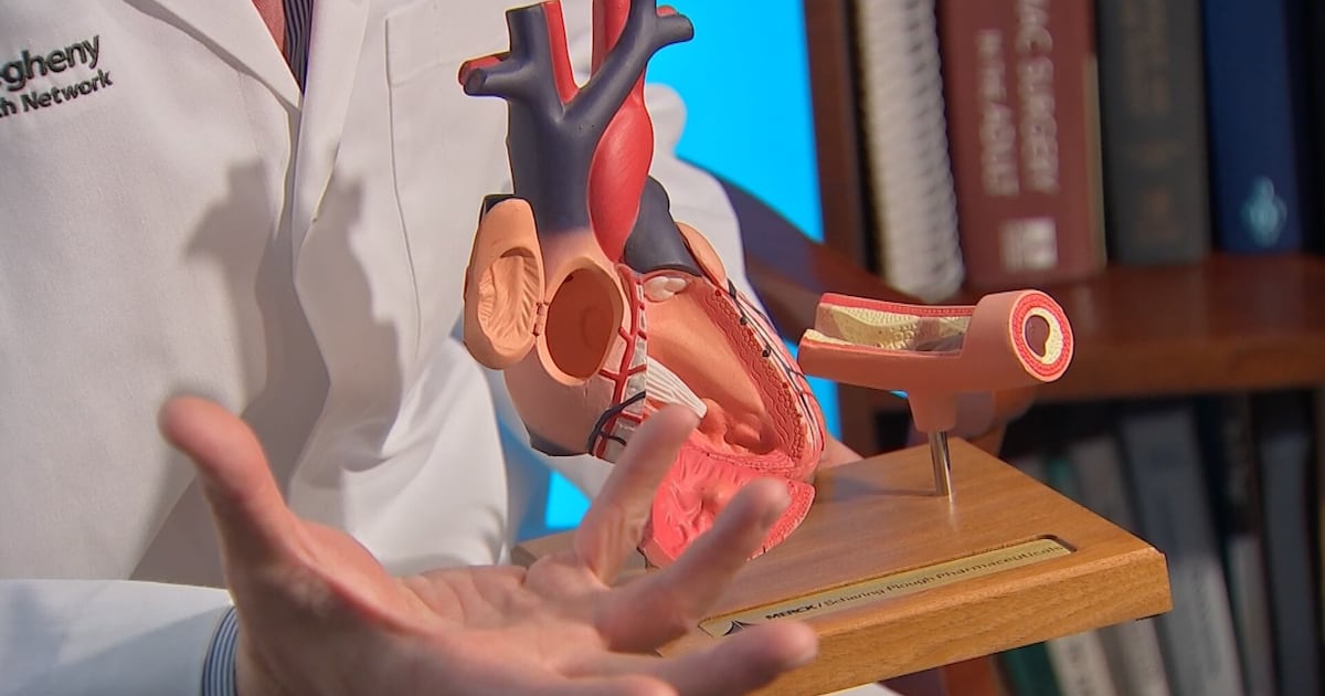 New procedure to fix common heart issue being performed in Pittsburgh – WPXI