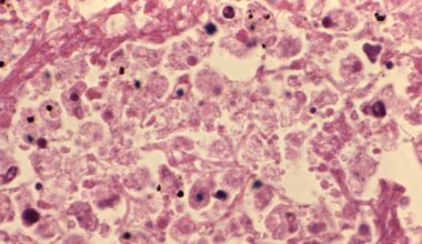 Patients at Pittsburgh VA Medical Center test positive for Legionella