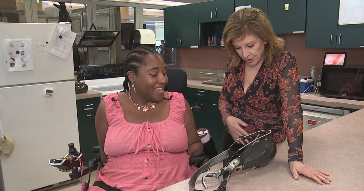 Philadelphia woman utilizes adaptive technology after losing limbs during COVID-19 battle