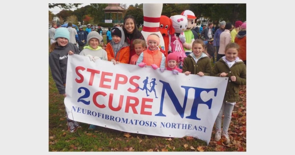 Neurofibromatosis advocates fighting for funding and awareness: "I can still have a good life"