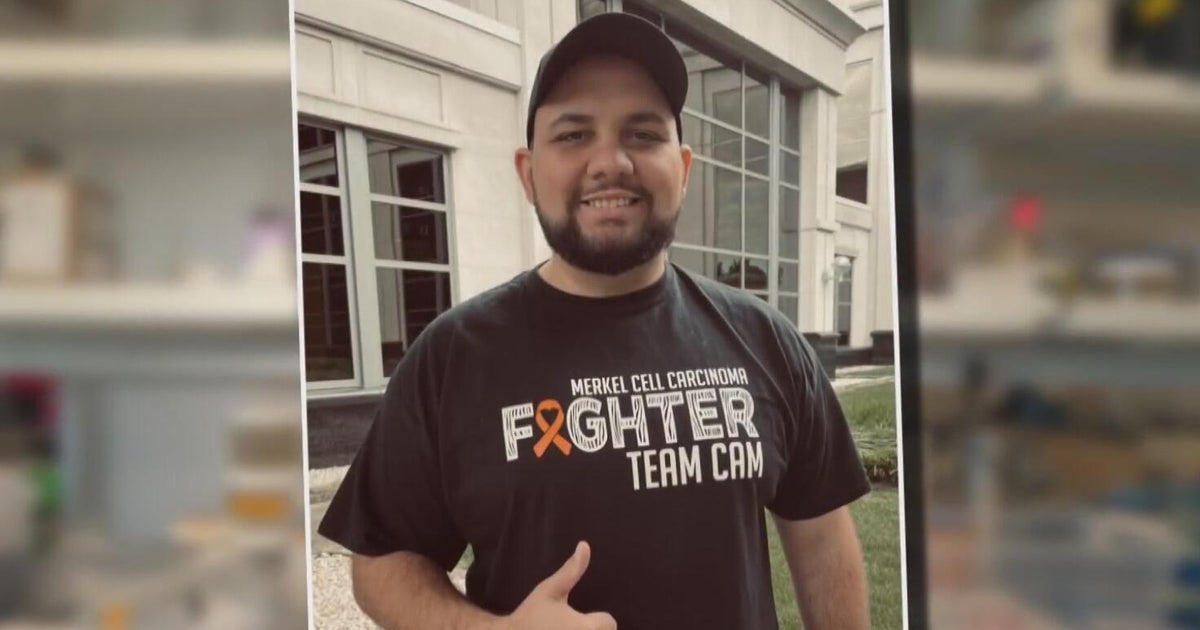 Man who beat "unicorn" case of Merkel cell carcinoma to ride in Pittsburgh's Rush to Crush Cancer