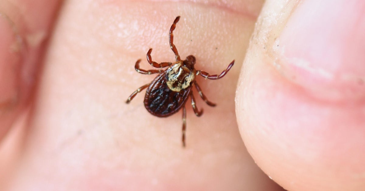 Pittsburgh doctor warns about uptick in tick-borne diseases