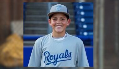 NJ boy hospitalized after being hit in the head with baseball – NBC10 Philadelphia