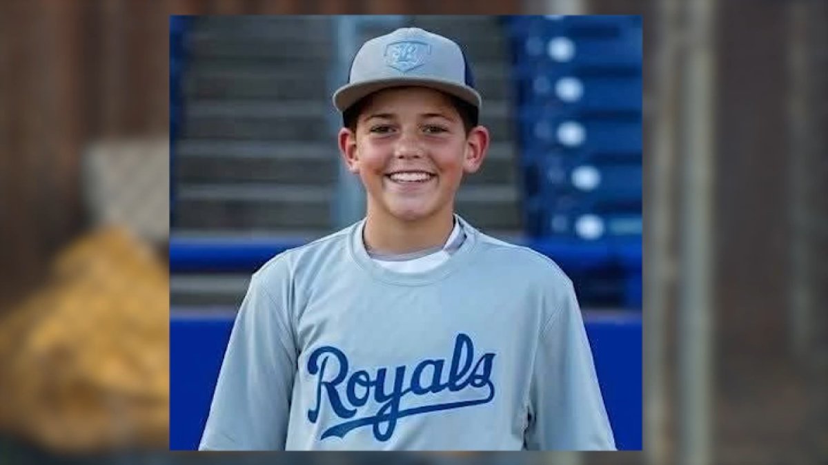 NJ boy hospitalized after being hit in the head with baseball – NBC10 Philadelphia