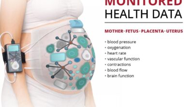 Carnegie Mellon Team Awarded ARPA-H Contract to Transform Care During Labor and Childbirth | National