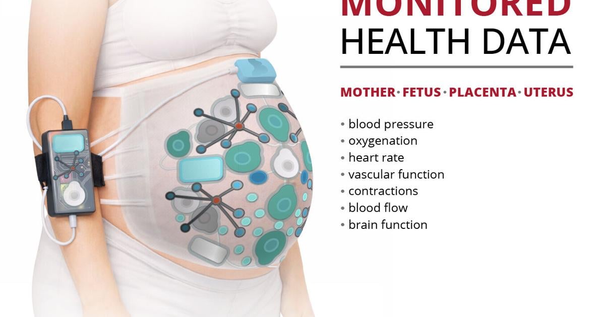 Carnegie Mellon Team Awarded ARPA-H Contract to Transform Care During Labor and Childbirth | National