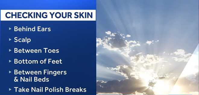 Melanoma, the fifth most common cancer in the U.S., is projected to become the second most common within 15 years, as cases continue to rise across the country. melanoma, the fifth most common cancer in the u.s., is projected to become the second most common within 15 years, as cases continue to rise across the country.