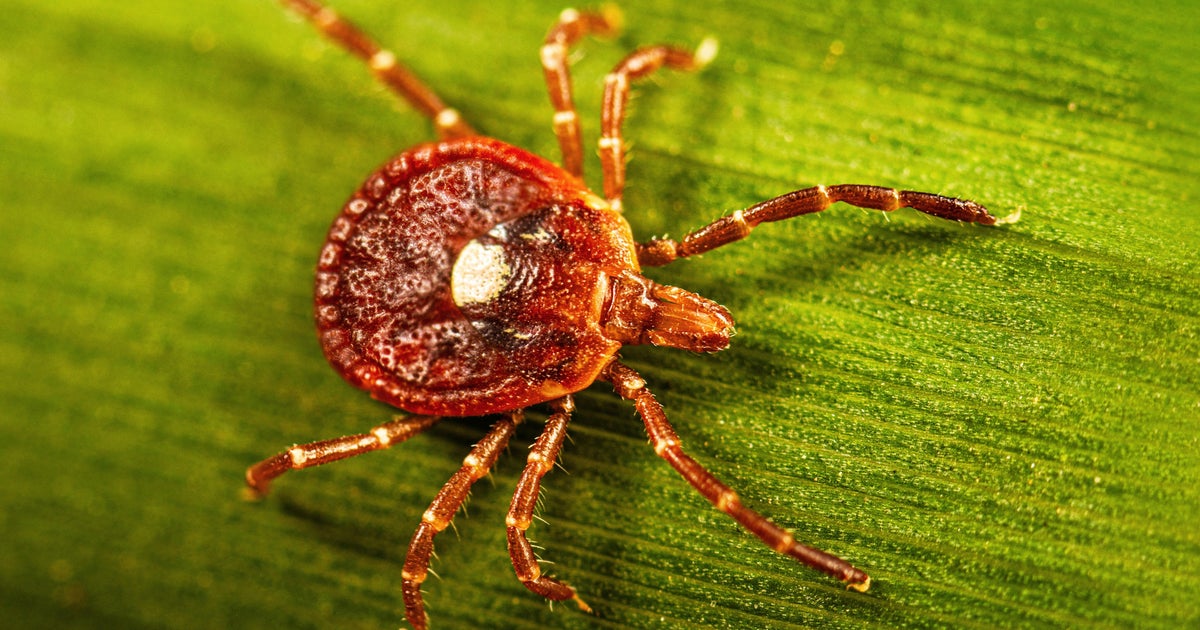 Pennsylvania health officials tracking red meat allergy caused by lone star tick