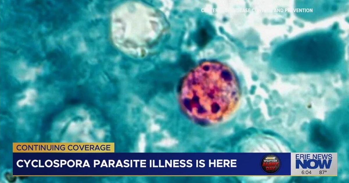 Health Officials Warn of Cyclospora Cases as Suspected Foodborne Illness Appears in Erie County | News