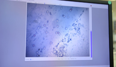 7 Cyclosporiasis Cases Confirmed in Erie County | Local News