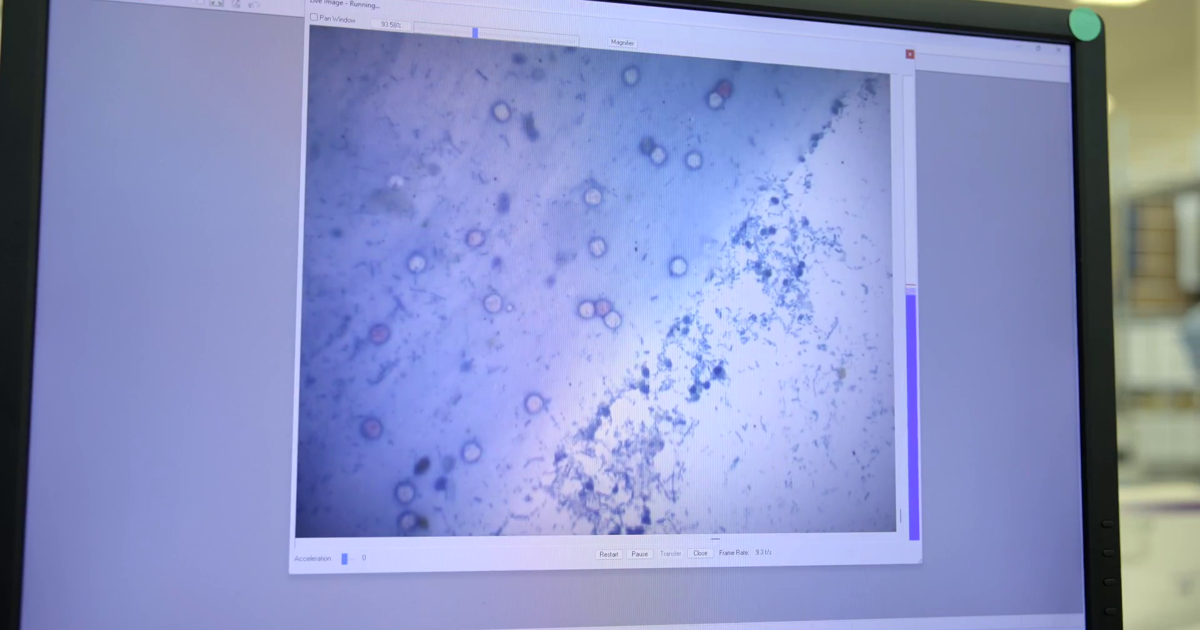 7 Cyclosporiasis Cases Confirmed in Erie County | Local News