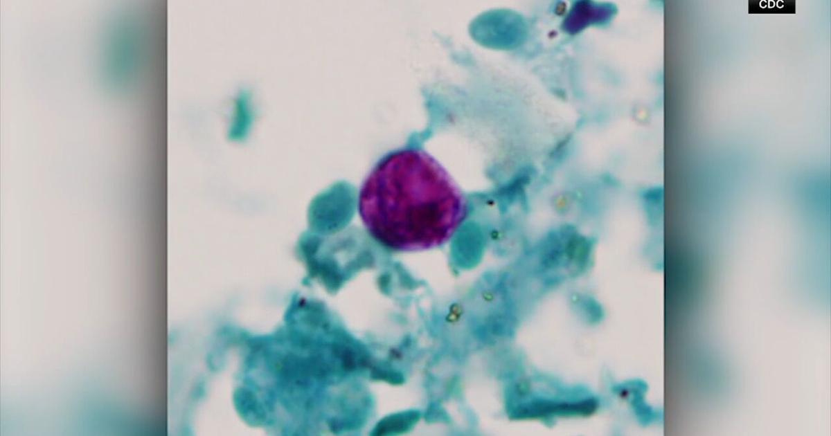 Cyclospora outbreak: 46 cases in New Jersey, 28 in Pennsylvania, including 5 cases in Bucks Co. | Pennsylvania News