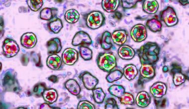 Measles virus