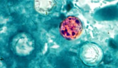 Allegheny County reports 35 cyclosporiasis cases, 2 hospitalizations as officials probe connection to outbreak