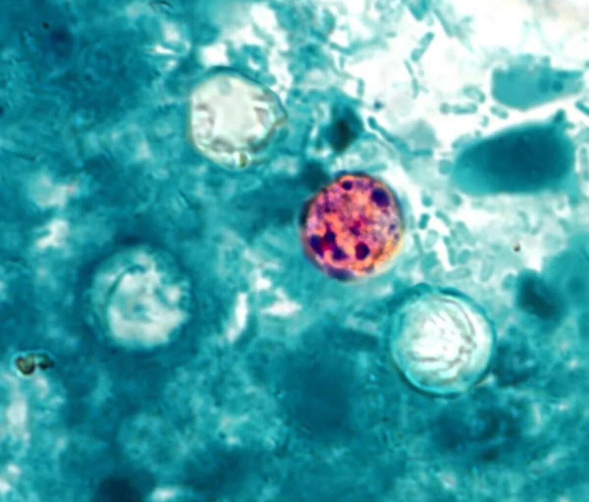 Pennsylvania explosive diarrhea outbreak case numbers, prevention tips