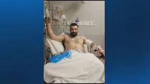 Pennsylvania man recovering after being bitten by rattlesnake