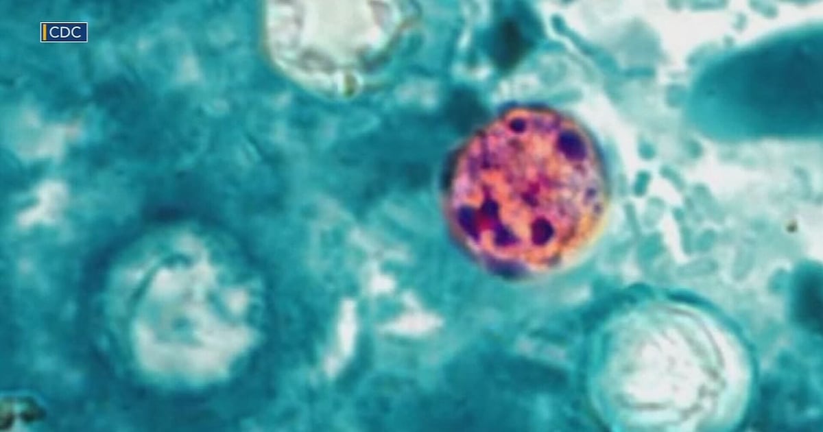 Allegheny County Health Department reports 11 cases of Cyclosporiasis