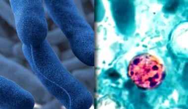 Cyclospora outbreak spreads to Pennsylvania, 8 other states