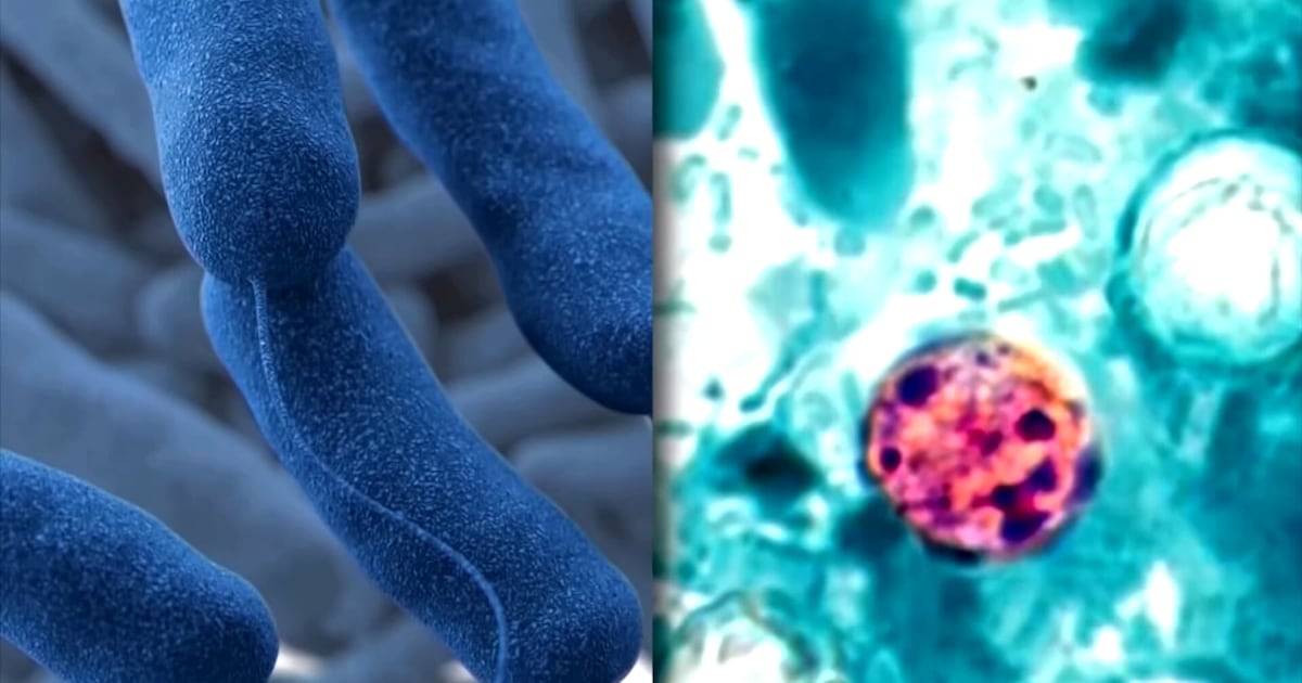Cyclospora outbreak spreads to Pennsylvania, 8 other states