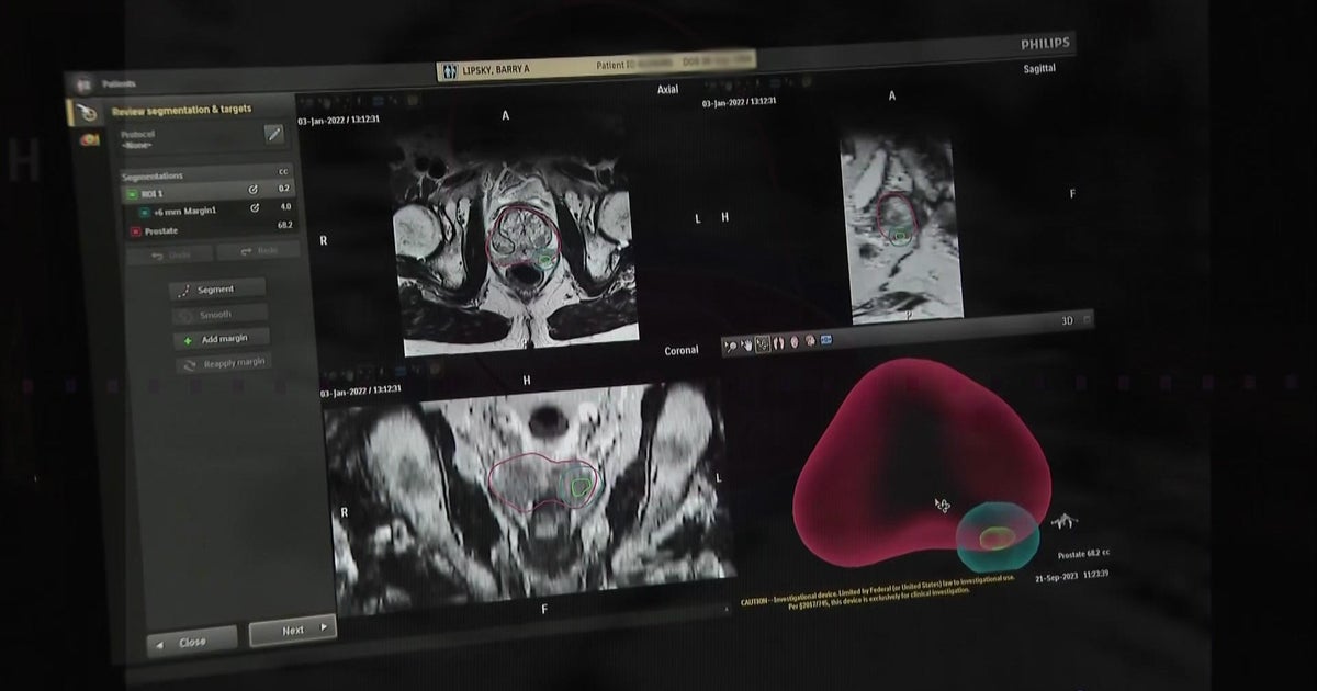 Pittsburgh-area lawmakers and organizations aim to raise awareness about prostate cancer risks