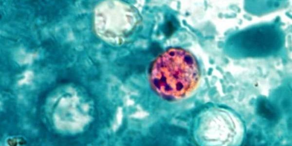 11 Cyclosporiasis Cases Confirmed in Allegheny Co.