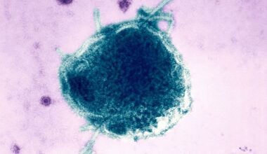 RFK Jr. and Josh Shapiro feud over measles-related deaths in Pennsylvania