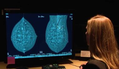 Pittsburgh woman credits mammogram technology for cancer detection