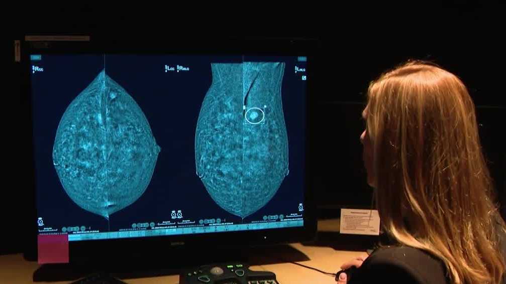 Pittsburgh woman credits mammogram technology for cancer detection