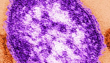 Dispute arises over Pa. measles deaths as RFK Jr., local coroner question state findings | Reading Area