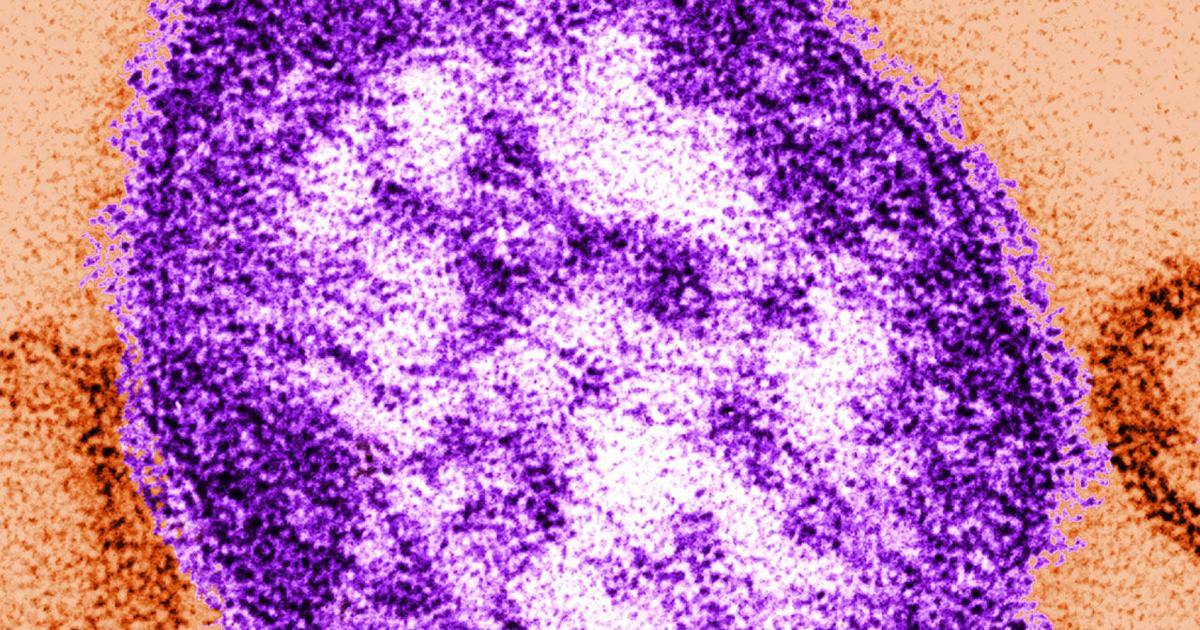 Dispute arises over Pa. measles deaths as RFK Jr., local coroner question state findings | Reading Area