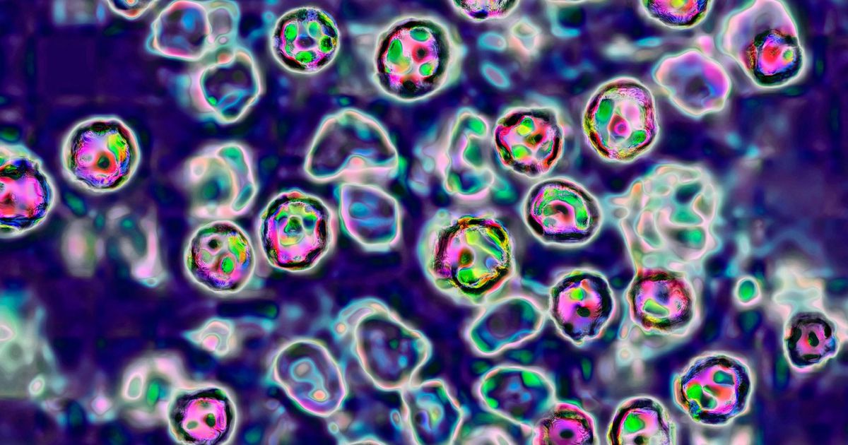 Two people in Pennsylvania die from measles :: WRAL.com