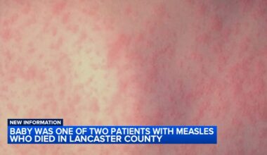Baby among 2 unvaccinated measles deaths in Lancaster County, Pennsylvania officials say