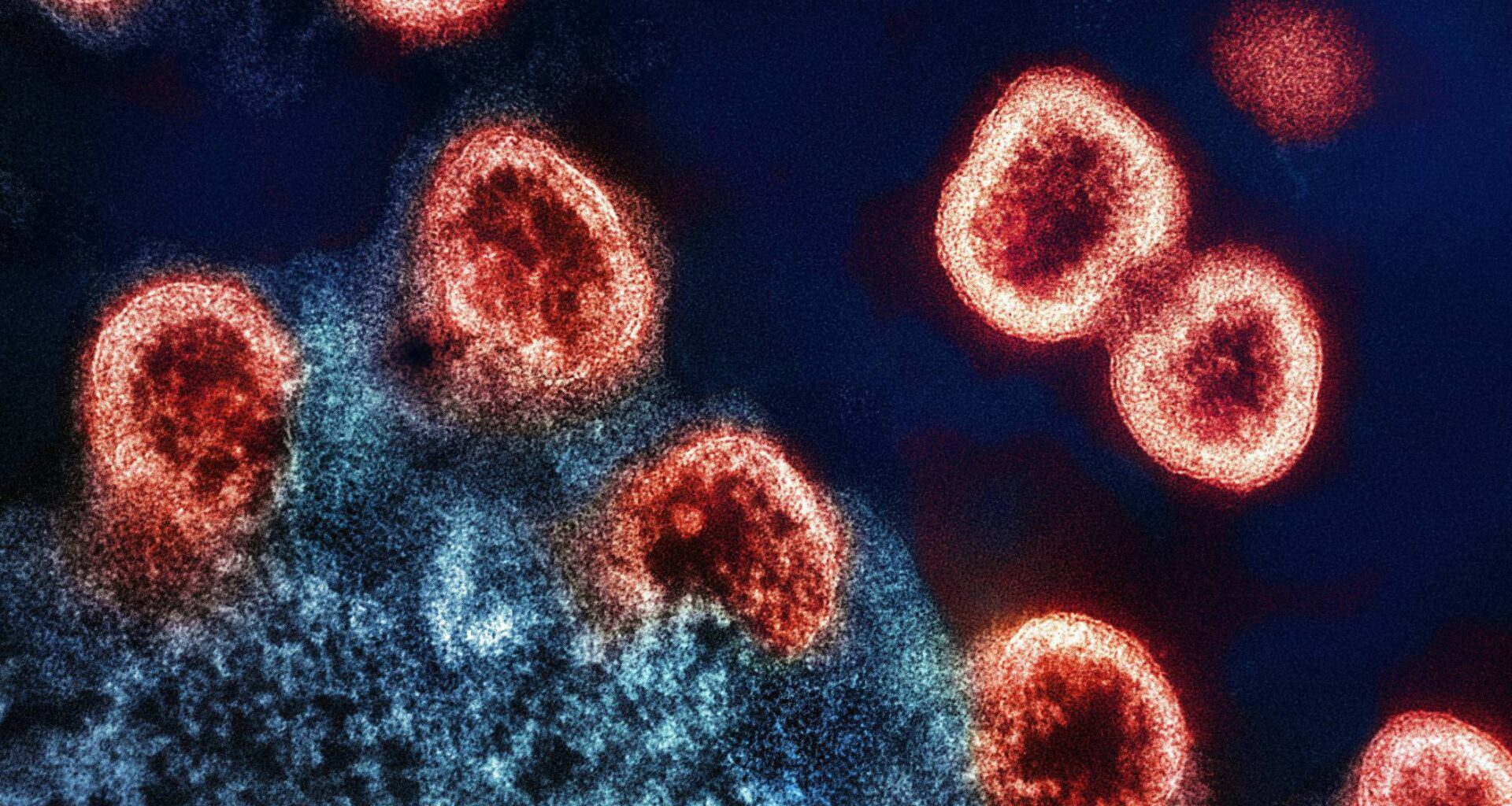 Measure bolstering city’s STI, HIV, AIDS response approved on second reading