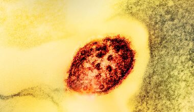 2 Measles-related Deaths Reported in Pennsylvania