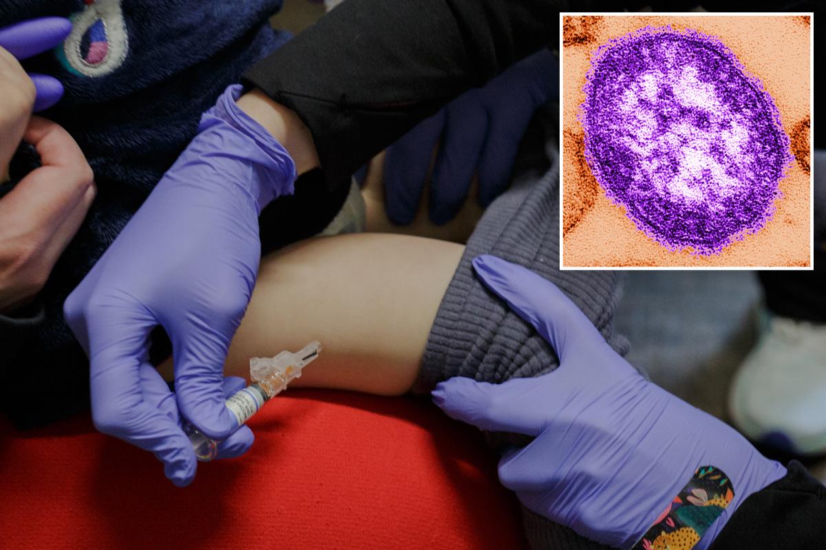 Pennsylvania woman dies from measles complications -- third virus-related death in the state this year