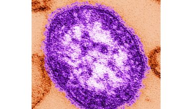 Pennsylvania officials report state's 3rd death involving measles