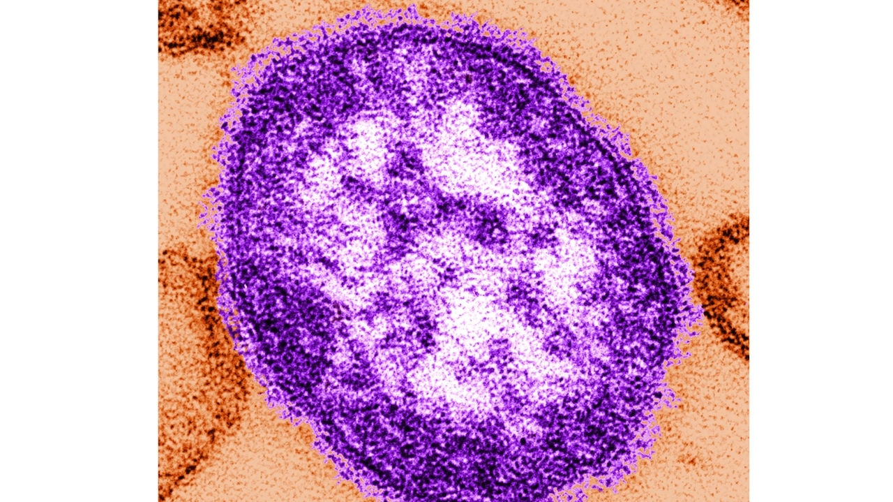 Pennsylvania officials report state's 3rd death involving measles