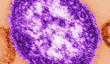 Adult woman dies of measles complications in growing Pennsylvania outbreak
