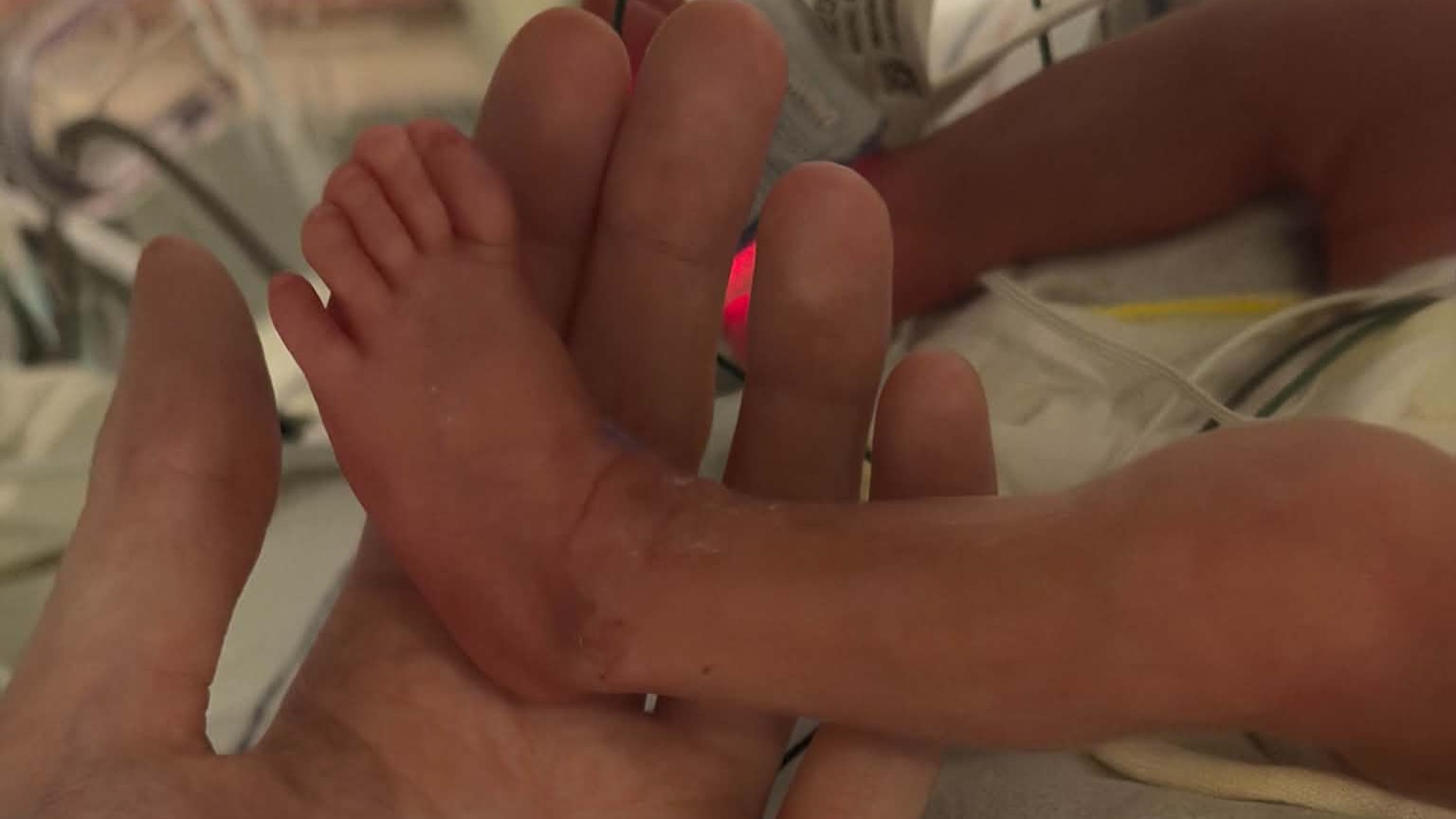 Brittany Nicole Sponenberg's son was born prematurely. Last week, the hospital told her he'd been exposed to measles in their neonatal intensive care unit.