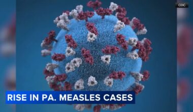 Chester County measles cases rise as state reports 676 infections
