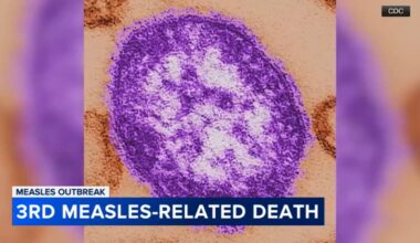 Public health advocate says Pennsylvania measles surge is a warning sign