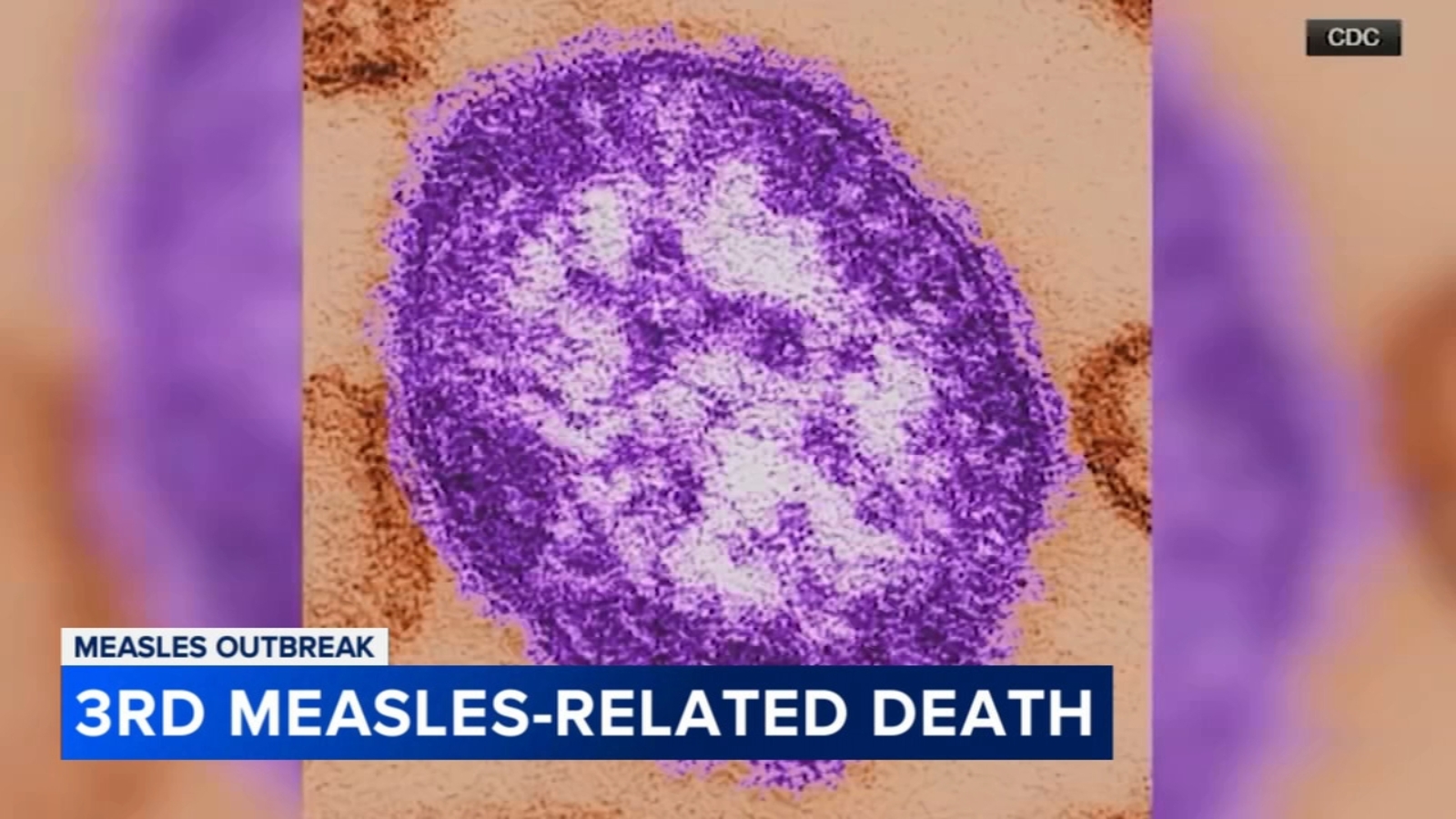 Public health advocate says Pennsylvania measles surge is a warning sign